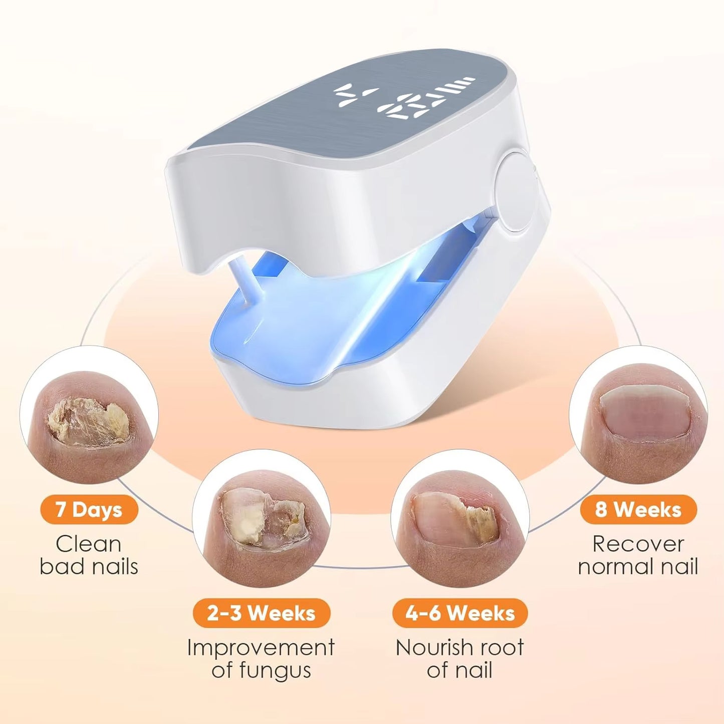 LED Nail Fungus Remover – Rechargeable Laser Treatment Device