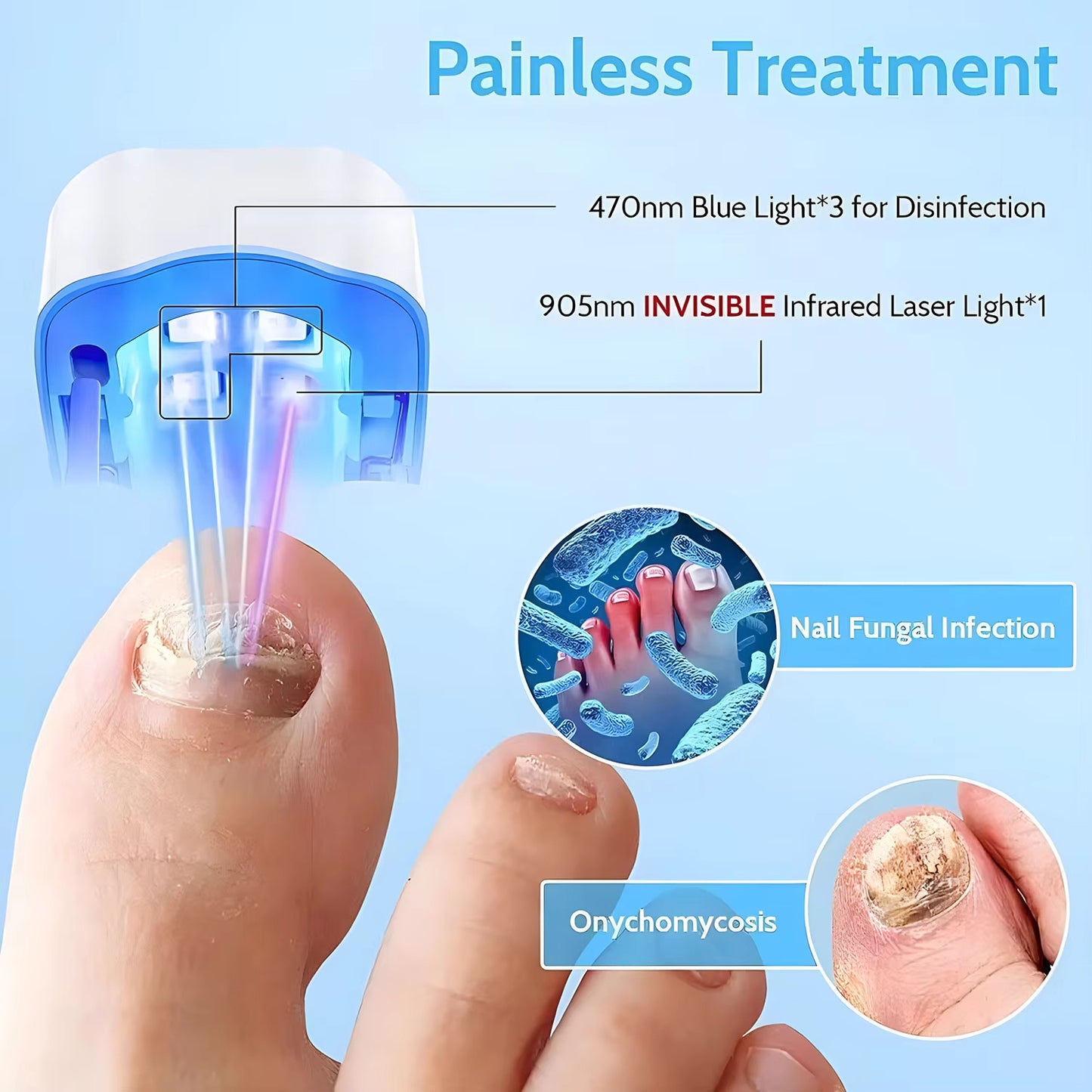 LED Nail Fungus Remover – Rechargeable Laser Treatment Device